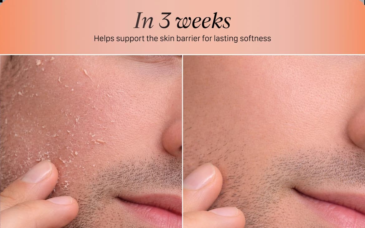 skin novera products